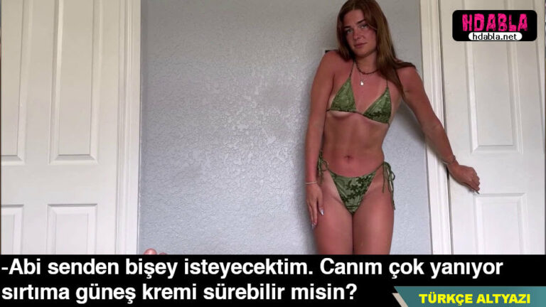 kiz kardesim sahilde uyuya kalmis yanan yerlerine krem surmemi istiyor.jpg